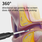 Load image into Gallery viewer, Smart HD Ear Cleaner with Camera – Wireless Otoscope Wax Removal Tool for Baby &amp; Adults (iOS &amp; Android Compatible - Gardino