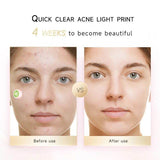 Load image into Gallery viewer, Electronic Acne Patches – Red Light Therapy Zit Patch (6 Pack) - Gardino