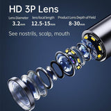 Load image into Gallery viewer, Smart HD Ear Cleaner with Camera – Wireless Otoscope Wax Removal Tool for Baby &amp; Adults (iOS &amp; Android Compatible - Gardino