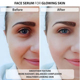 Load image into Gallery viewer, 10% Vitamin C Face Serum By Beauty Essence | With 5% Niacinamide | All Skin Types | For Men &amp; Women | Helps in Skin Brightening &amp; Pigmentation Removal | 30ml
